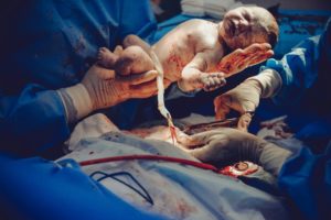 How Many C-Sections Can You Have Safely? Risks and More